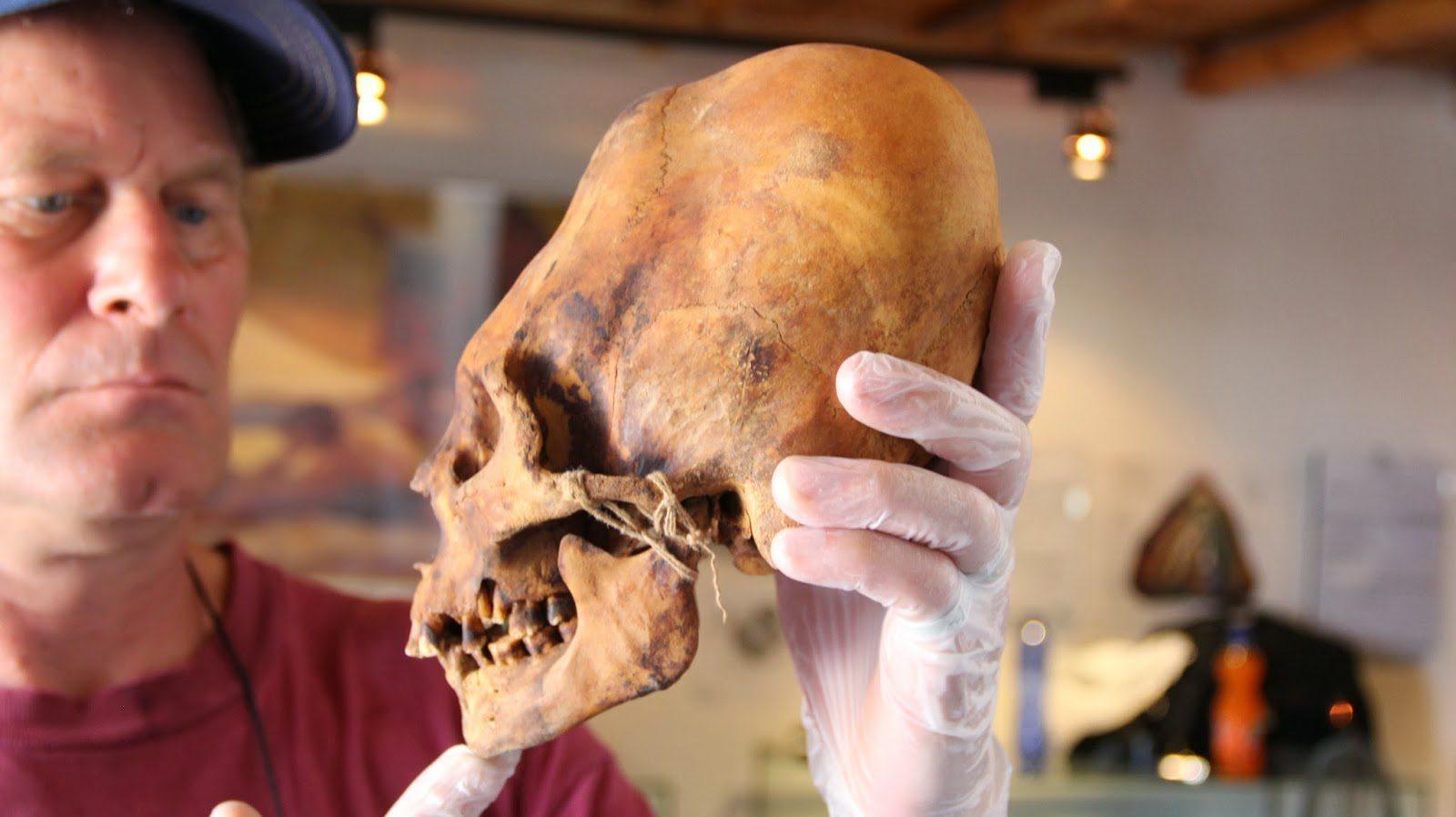 Brien Foerster Examines Elongated Paracas Skull